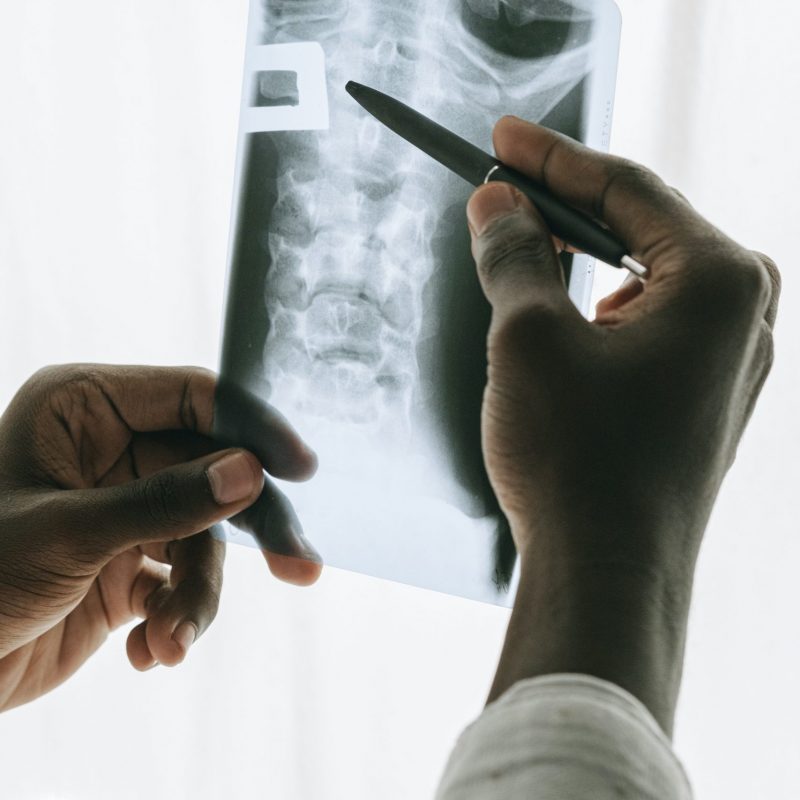 radiografia-scaled-800x800 otorrinolaringólogo
